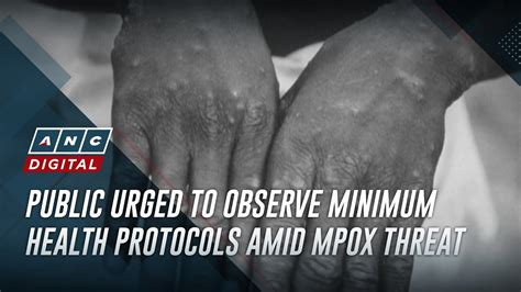 5 star hotel manila|DOH urges public to observe minimum precaution vs mpox.